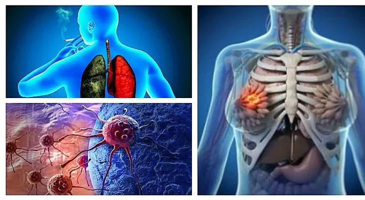 Científicos acaban de descubrir la forma correcta para tratar el cáncer 