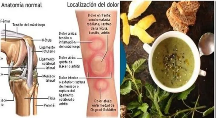Te duelen las rodillas y articulaciones? eliminalo en un día sin necesidad de inyecciones