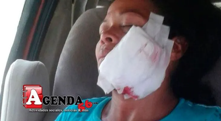 Mujer hiere en la cara con una botella a una vecina 
