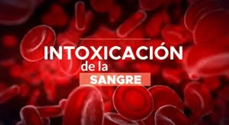 Enfermedades por intoxicación sanguínea: Una Dra nos dice de qué se trata 