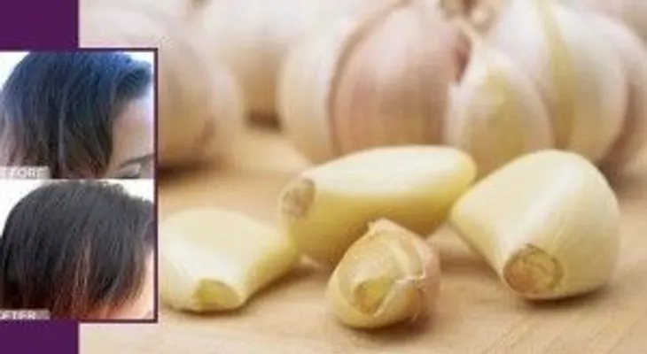 Jugo de ajo contra la caída del cabello