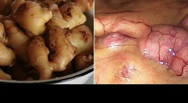 El jenjibre, mira lo que le hace al cuerpo si lo comes todos los días