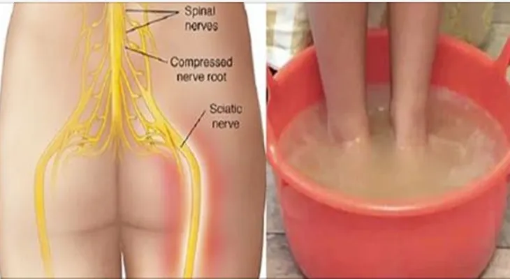 El dolor del nervio ciático y cómo decirle adios con este médoto natural