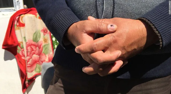 Dentro del territorio de ISIS: el horror de ser escudo humano