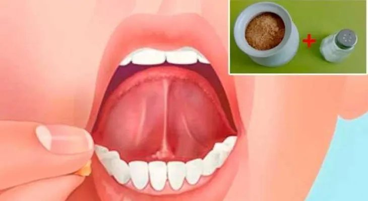 Coloca sal con azúcar debajo de tu lengua y el resultado te dejará asombrado (VIDEO)
