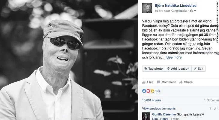 Facebook se disculpa por retirar (dos veces) una foto de un bombero quemado