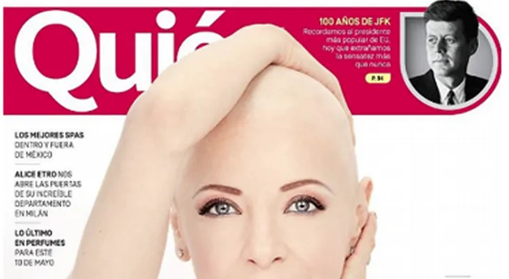 Edith González, pese a su terrible enfermedad posa sin peluca para la portada de una revista