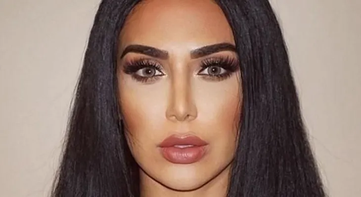 Kardashian: "Le dijimos que tenía lesión cerebral"