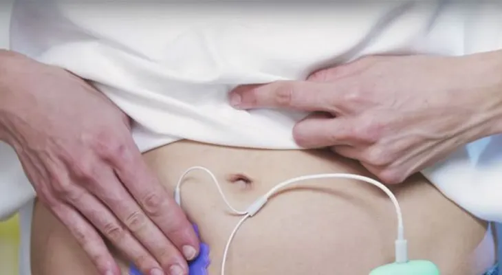 Este dispositivo acabará con el dolor menstrual