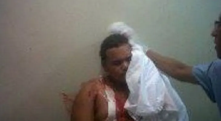 Joven denuncia golpiza le dio un policía en Montecristi