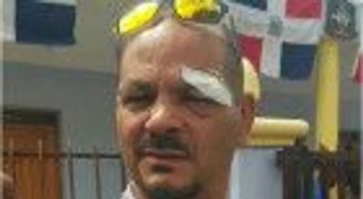 Alcalde dominicano herido macanazo