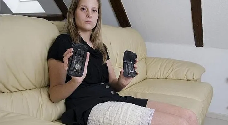 Joven sufre quemaduras al explotarle su Galaxy S3