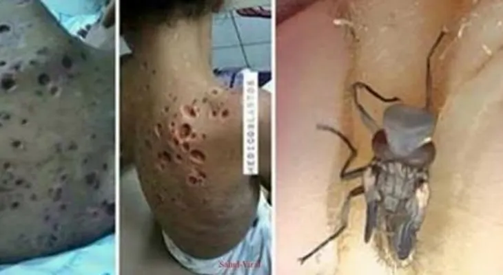 ADVIERTEN: La picadura de este mosquito puede ser mortal (VIDEO)