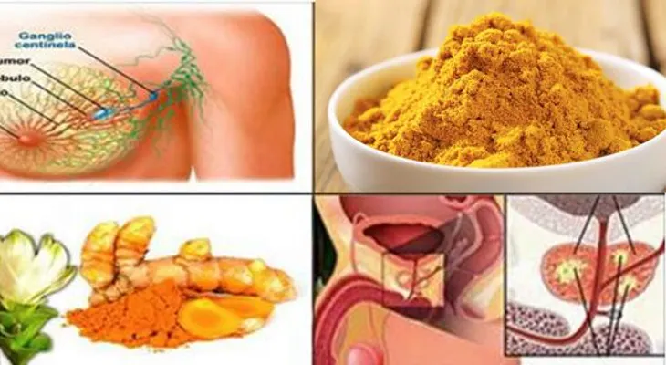 Mejor que la quimioterapia: este ingrediente mata al cáncer no a los pacientes