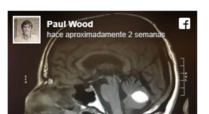 Ocurrió un milagro: Desaparece tumor cerebral, justo antes de ser operado por los médicos 