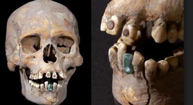 México: Hallan la Mujer de Tlailotlacan, un esqueleto con piritas incrustadas en los dientes 