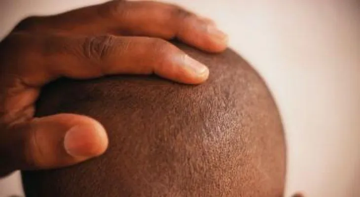 Datos curiosos sobre el cabello (y los problemas capilares)