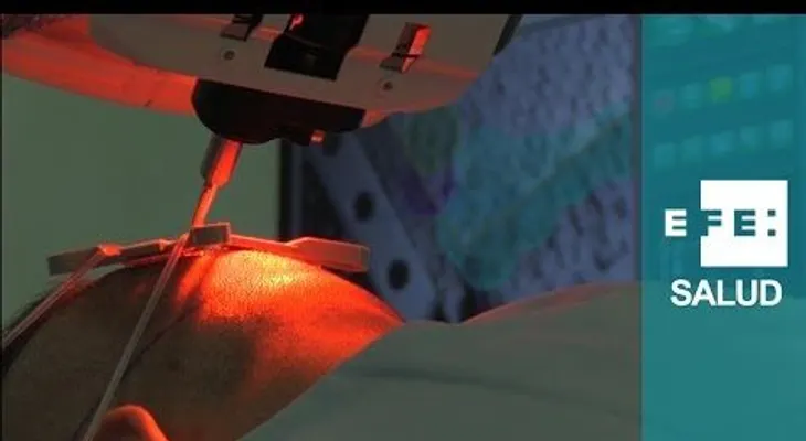 Un  robot anticalvicie (VIDEO)