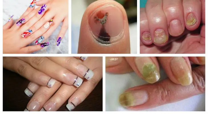 Usaba uñas acrílicas y lo que le pasó te dejara sin alientos 