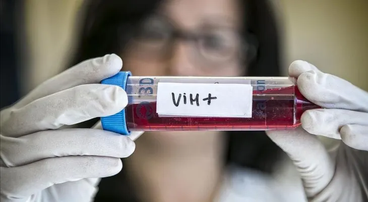 Científicas  hacen importante estudio para aumentar tiempo de vida portadores VIH