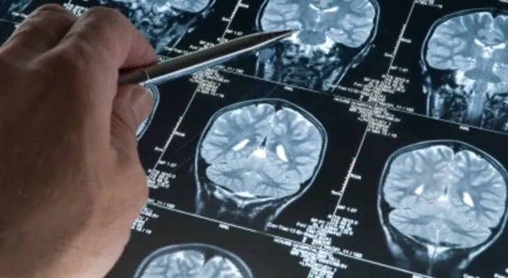 Jazz y rap, dos estilos que necesitan un cerebro improvisador