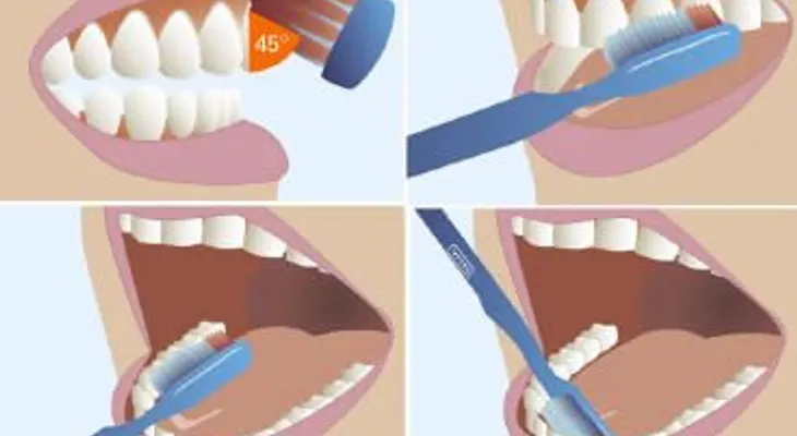 ¿Cuál es la mejor manera de cepillarse los dientes?
