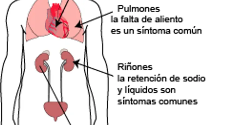 Hipertensión Pulmonar: Causas, Síntomas, Diagnóstico, Tratamiento