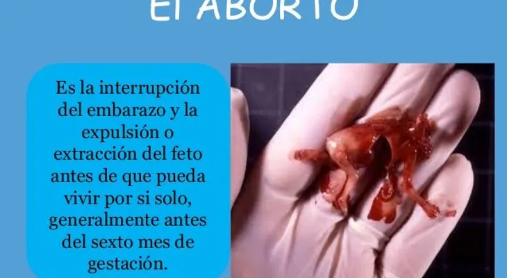  La ONU pide a R.Dominicana que despenalice el aborto en algunos supuestos 