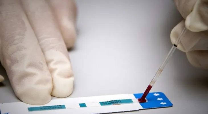 Será indemnizado con 40 mil dólares, un chileno que supo que tenía VIH 3 años después de prueba 