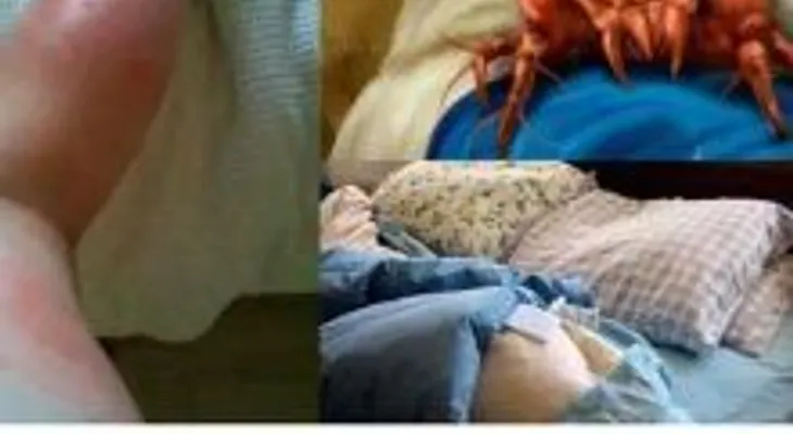 Con solo hacer esto, puede eliminar más de un millón de ácaros de tu cama
