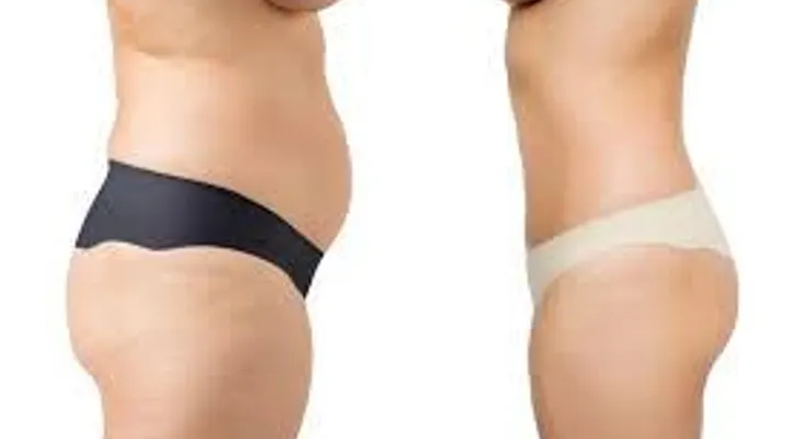Cómo bajar 3 kilos en un solo día y tener un vientre plano 