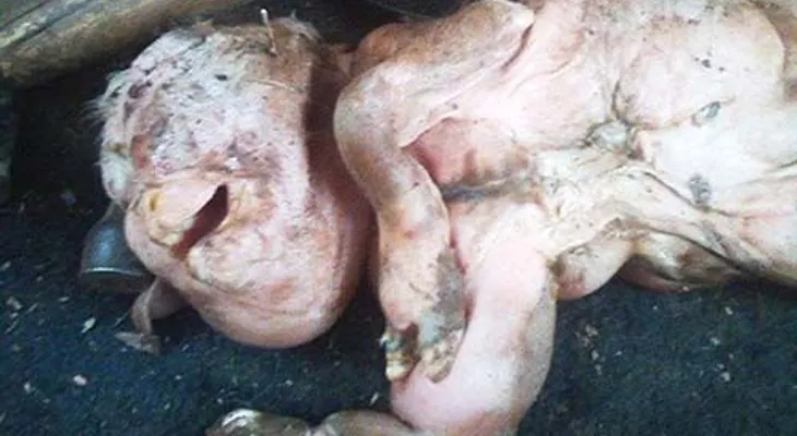 Nace otro bebé con rasgo de hombre lobo 