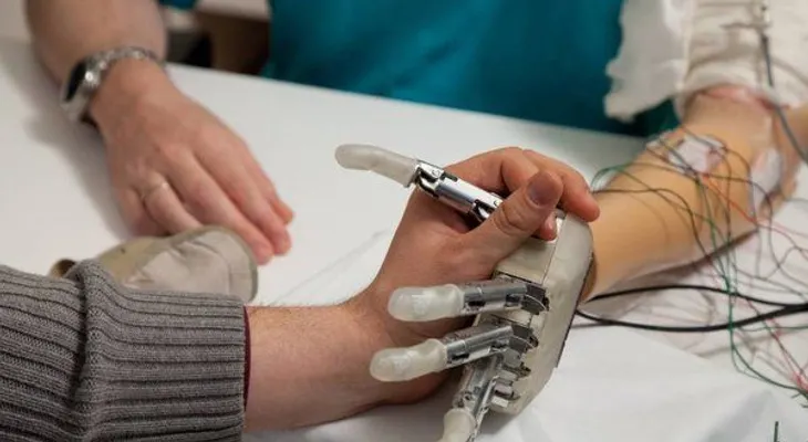  Abren laboratorio en Miami para producir prótesis con impresoras 3D 
