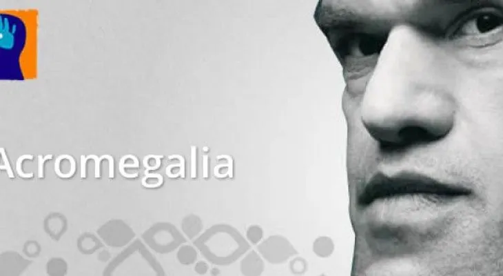 La movilidad en pacientes con acromegalia puede verse afectada