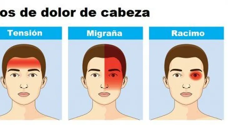 Lo que los dolores de cabeza revelan sobre tu salud