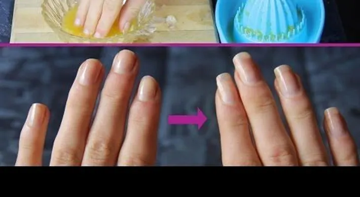 Una mujer sumerge las uñas en 2 conocidos productos y un par de semanas ¡NO PUEDE CREER LO QUE VE!