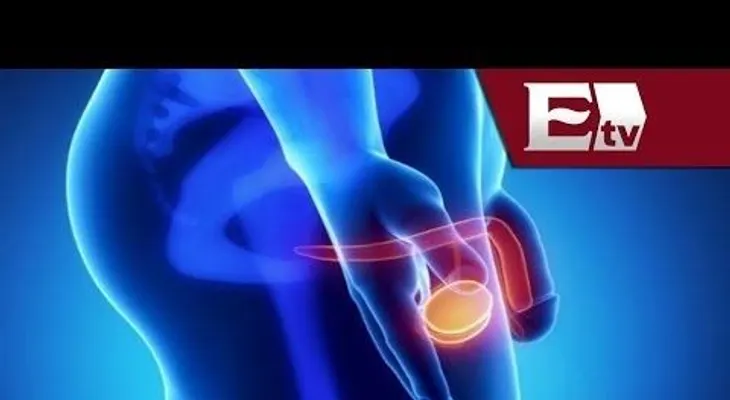 Doctor Víctor Corona: Cáncer de próstata: Síntomas y factores de riesgo