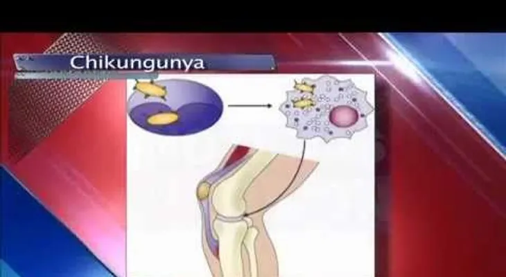 Conozca el origen del Chikungunya