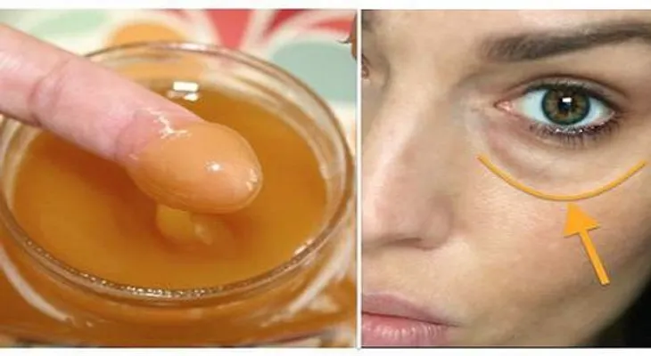 Ponga esta mezcla en su cara durante 15 minutos para borrar las ojeras y bolsas!