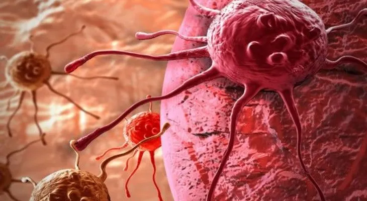 Nanomedicamentos, láser y ultrasonido: nuevas armas contra el cáncer