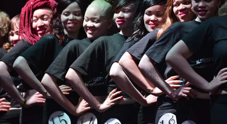 Realizan concurso de belleza de albinos para luchar contra los prejuicios en Kenia