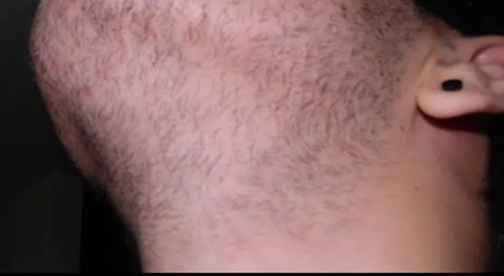 ¿Como hacer crecer la barba?
