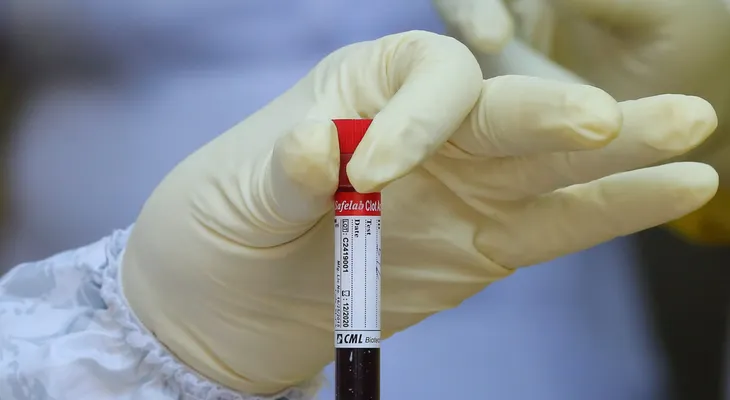Sangre tipo O podría ofrecer cierta protección contra la infección por COVID-19