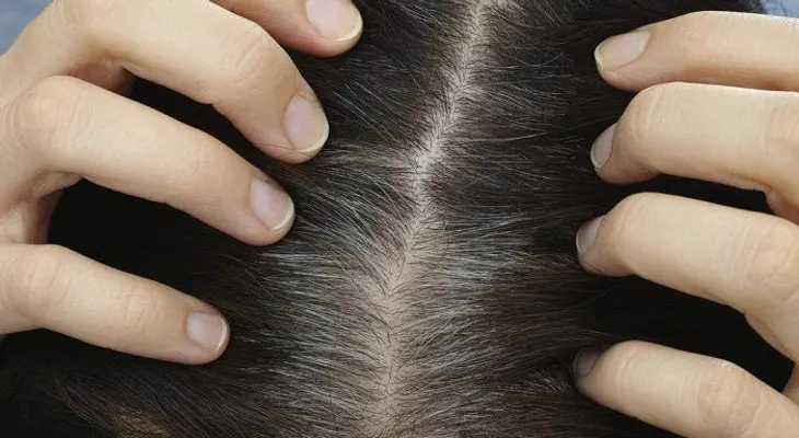 Aceite de coco y limón para normalizar el color natural de pelo