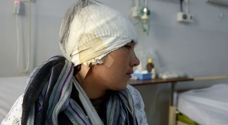 La entregaron en matrimonio a los 13 años y el marido le cortó las orejas por mirar a otros hombres