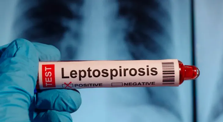 Casos de leptospirosis aumentan 154% en República Dominicana; muertes suben a 19