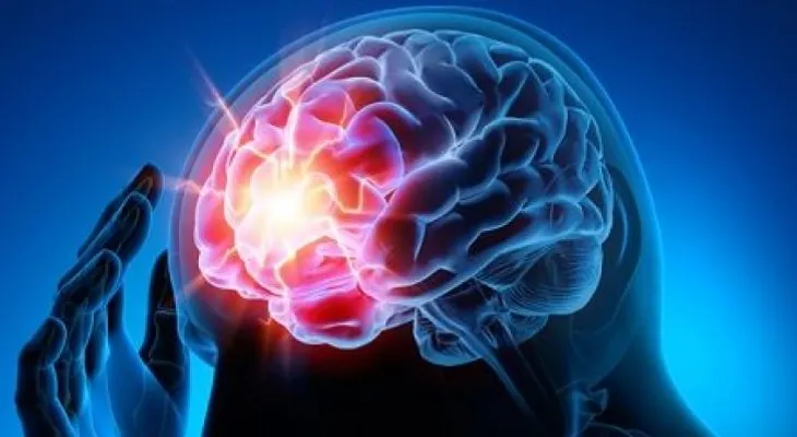 7 tips para prevenir un aneurisma