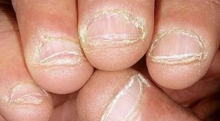 11 razones para nunca más te muerda las uñas