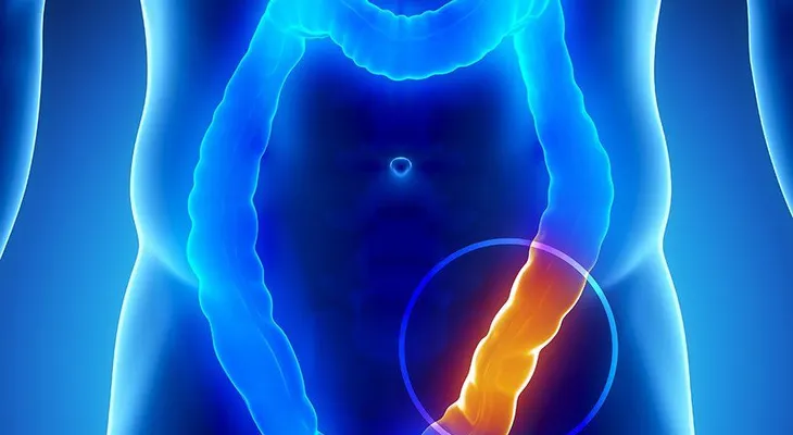 Ensalada detox para limpiar el colon en 3 días
