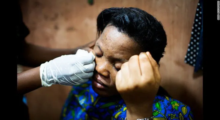 Luces y sombras: aclaramiento de la piel en Uganda